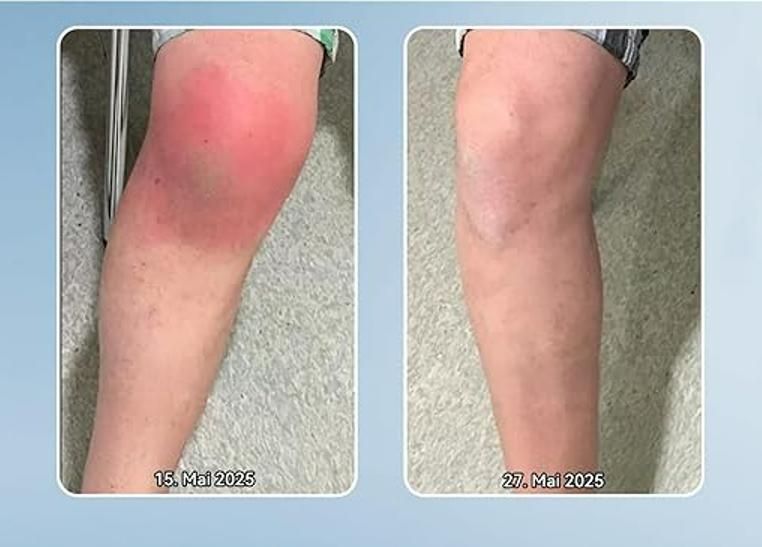 BPC-157 Gelenk-Helicreme 100 gm Pack of 1