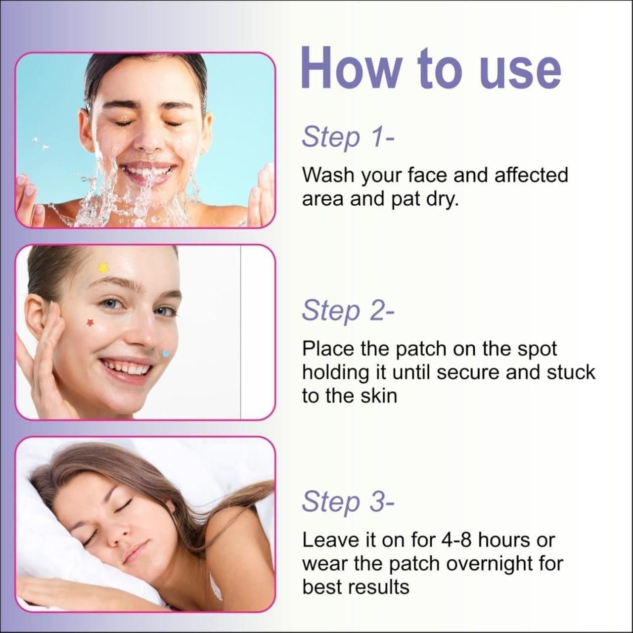 30 Pcs Pimple Patches