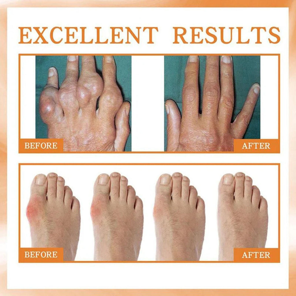 Bee Venom Beesae Arthritis Spreay 100ML